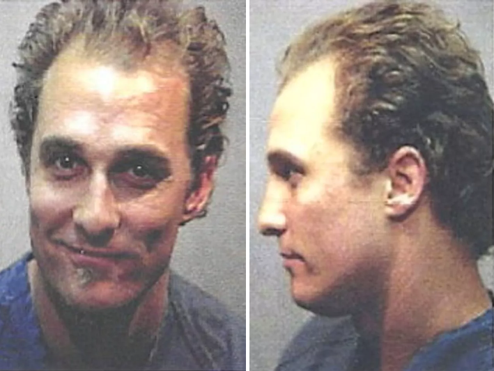 Celebrities who have had hair transplants Matthew McConaughey